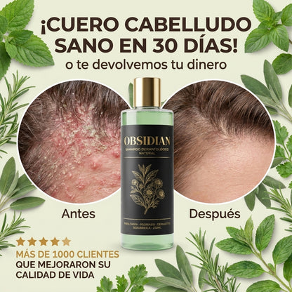 OBSIDIAN | SHAMPOO Natural para caspa, psoriasis capilar y dermatitis seborreica