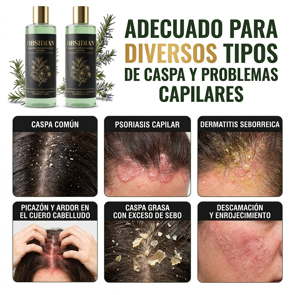 OBSIDIAN | SHAMPOO Natural para caspa, psoriasis capilar y dermatitis seborreica